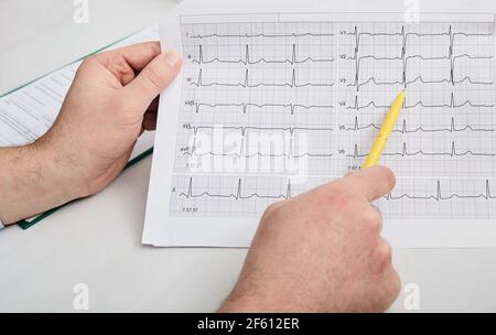 Kardiogrammtest, Nahaufnahme des EKG-Berichts. Der Arzt analysiert die Ergebnisse des Kardiogramms des Herzens eines Patienten für die Diagnose und Behandlung von Herzerkrankungen Stockfoto