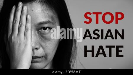 Stoppen Sie die asiatische Hate-Poster-Kampagne. Asia Frau mit Prellung auf Armen und Gesicht, heben Sie eine Hand und decken eine Gesichtsseite. Wort stoppen asiatischen Hass auf Kopierraum Stockfoto