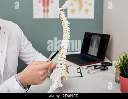 Der Arzt zeigt Problempunkte an einer Wirbelsäule anhand eines anatomischen Modells in einer Arztpraxis Stockfoto