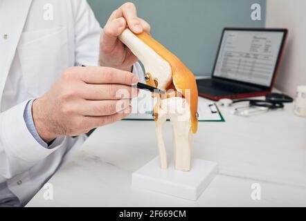 Traumatologe zeigt Stift auf Meniskus in einem Knie-Gelenk anatomischen Lehrmodell, Nahaufnahme. Behandlungskonzept für Meniskusrisse beim Menschen Stockfoto