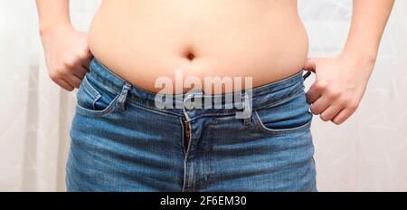 Adipositas. Fat Frau Hand hält übermäßige Bauchfett. Übergewichtige Frauen tragen eine Jeans Stockfoto