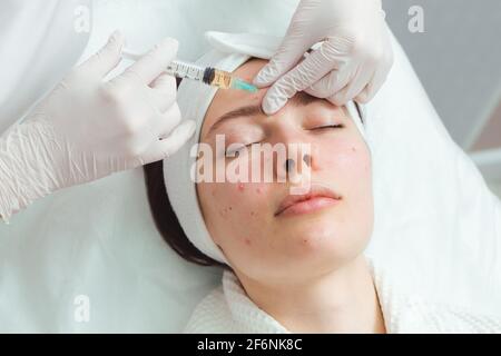 Eine junge Frau in einer Klinik für Kosmetologie, die sich einer Aknebehandlung mit Injektionen unterzieht. Ein wirksames Mittel gegen Akne Stockfoto