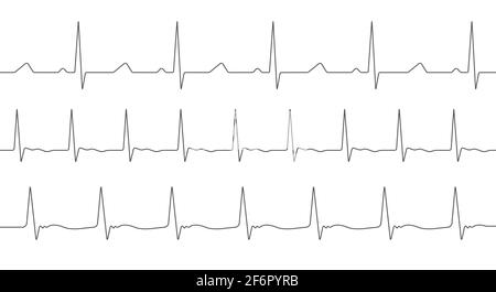 Kardiogramm eingestellt. Drei verschiedene. Heartbeat-Leitung. Verschiedene Herzschlag Welle Sammlung. Illustration isoliert auf weiß. Stockfoto