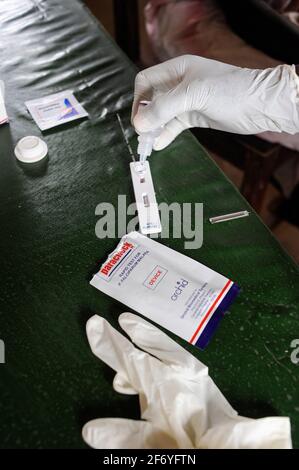 SÜDSUDAN, Rumbek, Gesundheitszentrum, Bluttest auf Malaria und andere Krankheiten / SUEDSUDAN Rumbek, Gesundheitsstation, Bluttest für Malaria und andere Krankheiten Stockfoto
