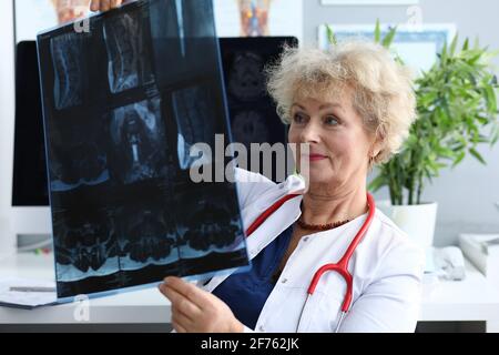 Ältere Ärztin hält Röntgenaufnahmen in Nahaufnahme Stockfoto