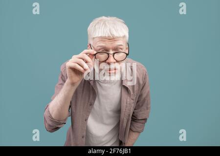 Schlechte Sehkraft. Albino-Mann in Brillen, die Augen zucken, schlechte Sicht haben und versuchen, etwas über blauem Hintergrund zu sehen Stockfoto