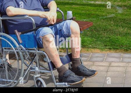 Älterer Mann mit Diabetes und Nierenerkrankungen sitzt auf dem Rollstuhl und läuft mit einem Assistenten im Park. Stockfoto