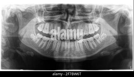 Handy, Telefon, Smartphone, Virus, Bildschirm, Gefahr, rot, Fehler, Web, Mobiltelefon, Antivirus, Hacker, Display, Sicherheit, Spam, Alarm, Angriff, Trojaner, Warni Stockfoto