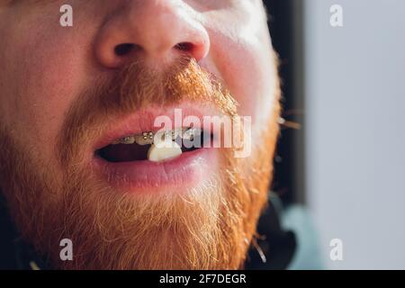 Ein kaukasischer Mann hält eine Pille zwischen seinem Finger, während er sie hält Es auf seine Zunge legen Stockfoto