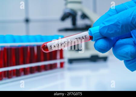 Reagenzglas für Test SADS-CoV. Schweine-akutes Durchfallsyndrom Coronavirus ist ein Coronavirus, das mit dem Rhinolophus bat Coronavirus HKU2 zusammenhängt Stockfoto