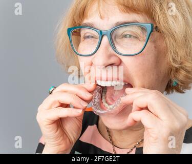 Eine glückliche ältere Frau zieht transparente, abnehmbare Hosenträger an. Kosmetische Zahnheilkunde für alle Altersgruppen Stockfoto