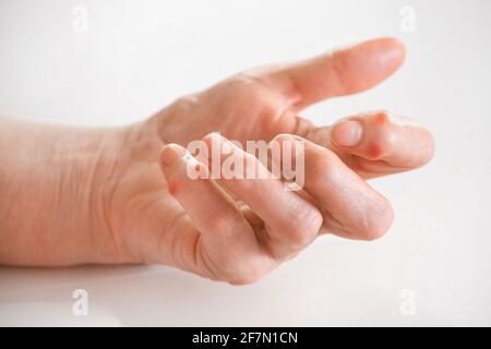 Kranke weibliche Finger der Hand eines älteren Mannes auf weißem Hintergrund. Stockfoto