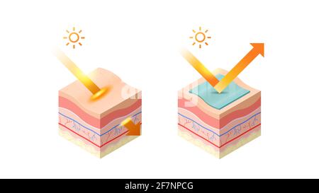 Schutz und dringen uv-Strahlen von der Sonne in die Epidermis von Hautquerschnitt der menschlichen Hautschichten Struktur Hautpflege medizinisches Konzept Flach horizontal Stock Vektor