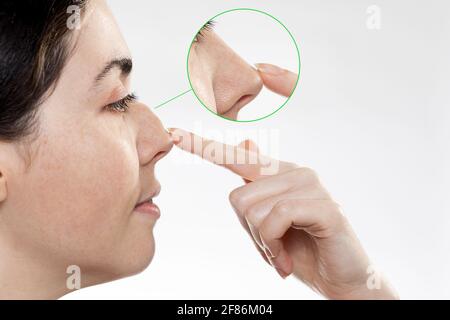Porträt einer lächelnden Frau, die das Ergebnis vor und nach der Rhinoplastik zeigt. Der Zeigefinger der Hand auf der Nasenspitze. Seitenansicht. Weißer Hintergr Stockfoto