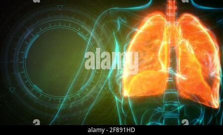 cg Medicine 3d-Illustration, menschliche Lunge von Heilung getroffen Stockfoto