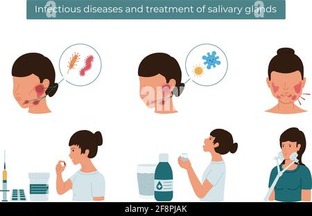 Vektor flache Darstellung von Infektionskrankheiten und Speicheldrüsenbehandlung. Stock Vektor