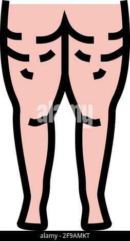 Cellulite Problem Farbe Symbol Vektor Illustration Stock Vektor