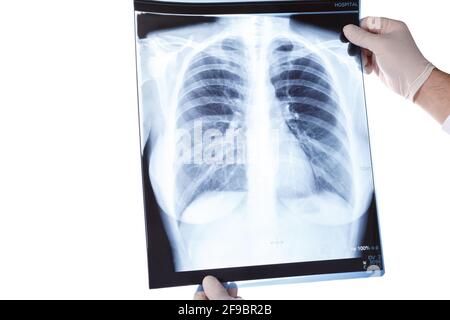 Arzt mit Handschuhen, Blick auf die Röntgenaufnahme der Brust, Nahaufnahme, Covid-19 Stockfoto
