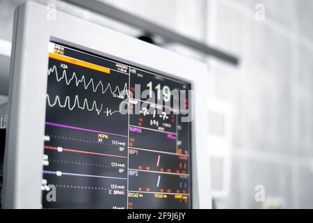 Die medizinische Monitormaschine im Operationsraum zeigt das normale Vitalzeichen des Patienten an. Stockfoto