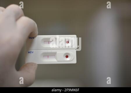 Negative Ergebnisse für die Kassette mit Hepatitis C-Schnelltests zur Prüfung von Antikörpern gegen das Hepatitis C-Virus Stockfoto
