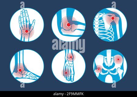 Sechs Symbole für Rheumatologie-Erkrankungen Stock Vektor