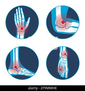 Vier Symbole für Rheumatologie-Erkrankungen Stock Vektor