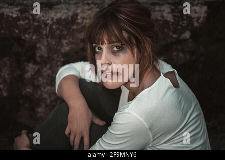 Nahaufnahme einer verzweifelten Frau im Profil, dass sie unter einer Gewalt leidet, Nasenblut hat und die Brusies unter zerschmetterten Augen. Stockfoto