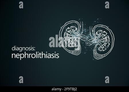 Nephrolithiasis Nierensteine Krankheit oder Urolithiasis. Nierenrechnung oder Steine, die die Harnwege blockieren.Designvorlage im minimalistischen Stil Stockfoto