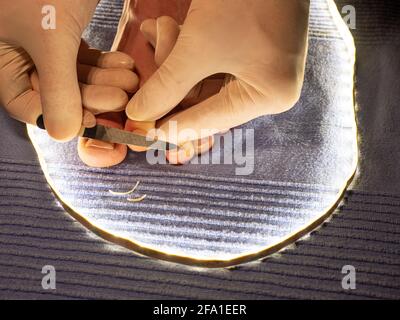 Hände in weißen sterilen Handschuhen feilten Zehennägel mit langer spitzer Feile auf männlichen Zehen. Pediküre auf blauem Handtuch Stockfoto