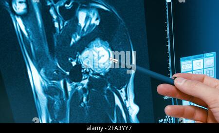 Zugeschnittene Ansicht der weiblichen Hand, die auf die Sagitalis des Hundegehirns zeigt, auf dem MRT-Bild. Untersuchung auf Tierklinik, die Pflege über Haustiere. Stockfoto