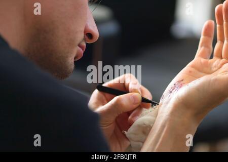 Abschürfungen an der Handfläche und Kratzer am rechten Arm eines erwachsenen Mannes. Behandlung zu Hause. Stockfoto