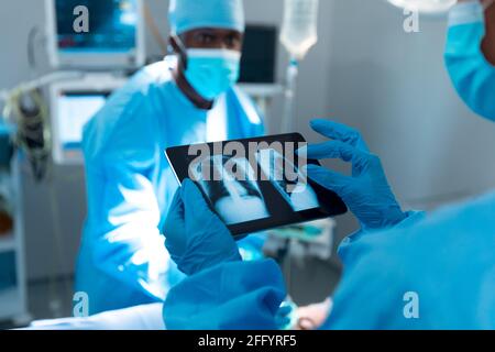 Arzt mit Operationshandschuhen, der die Röntgenaufnahme der Lunge auf einer Tablette betrachtet Stockfoto