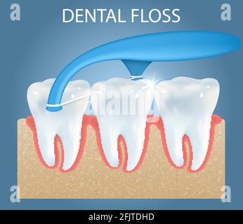 Mundpflege Zahnseide wählen ad Vektor Poster, Banner-Vorlage. Zahnreinigung Zahnseide Zahnstocher. Zahngesundheit und Hygiene Stock Vektor