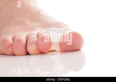 Bunion, Hallux valgus. Silikon-Zeh-Trennvorrichtung an Füßen isoliert auf weißem Hintergrund. Stockfoto
