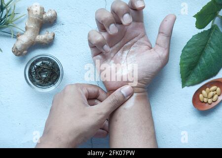 Mann, der alternative Medizin auf schmerzhafte Hand anwendet Stockfoto