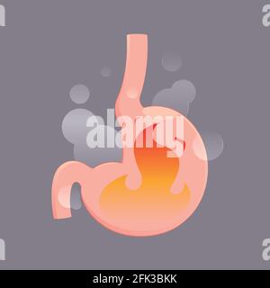 Illustration von saurem Reflux oder Sodbrennen, Cartoon-Vektor, Konzept mit interner Gesundheit Stock Vektor