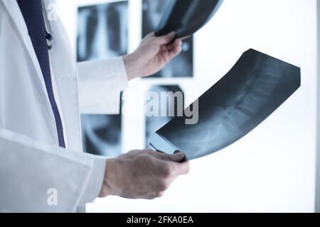 Arzt, der Röntgenfilme in der Klinik betrachtet Stockfoto