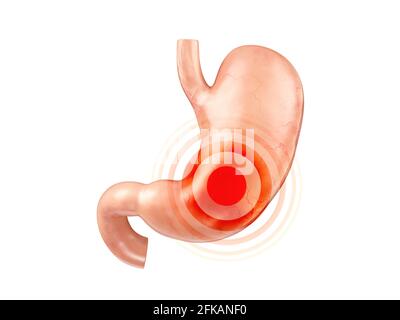 Anatomisch genaue realistische 3d-Darstellung des menschlichen inneren Organs - Magen mit Duodenum isoliert auf weißem Hintergrund Stockfoto