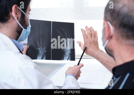 Junger Arzt untersucht Röntgenaufnahmen von Händen eines älteren Patienten mit Arthritis. Radiographie einer Hand. Stockfoto