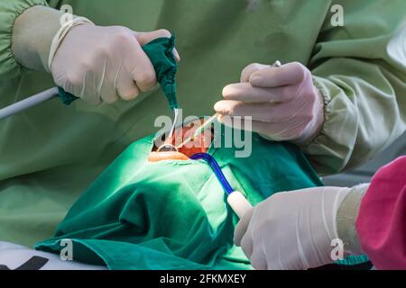 Hand des Zahnarztes, der die Zähne eines Patienten im Krankenhaus untersucht. Stockfoto