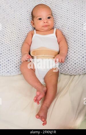 Baby in einer Nabelbruch-Bandage. Süßer kahler Säugling auf dem Bett Stockfoto