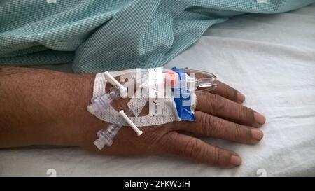 Hand mit peripheren intravenösen Kanülen oder Kathetern Stockfoto