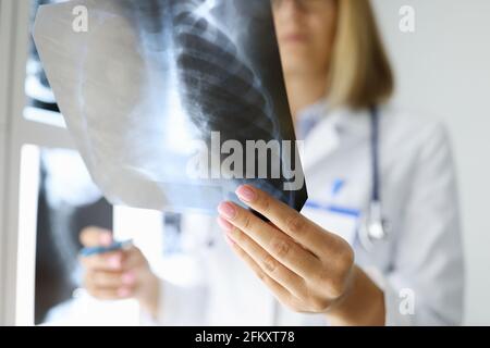 Die Hände des Arztes halten eine Röntgenaufnahme in der Arztpraxis. Stockfoto
