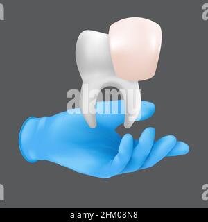 Zahnarzt Hand trägt blauen Schutz OP-Handschuh mit einem keramischen Modell des Zahnes. 3d realistische Vektor-Illustration von Porzellan Veneers concep Stock Vektor