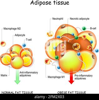 Adipozyten, Adipositas und Entzündungen. Normales Fettgewebe, Stoffwechsel und fettleibige Fettgewebe. Pathologie der Fettleibigkeit. Entzündungshemmend und entzündungshemmend Stock Vektor