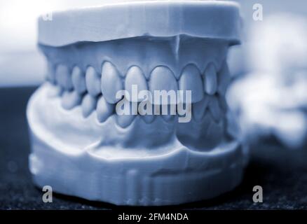 Ober- und Unterkiefer eines Mannes, der auf einem 3d-Drucker aus Photopolymer gedruckt wurde. Stockfoto