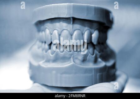 Ober- und Unterkiefer eines Mannes, der auf einem 3d-Drucker aus Photopolymer gedruckt wurde. Stockfoto