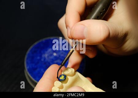Zahntechniker modelliert Zahnkronen mit heißem Wachs. Die Hände eines Zahntechnikers aus der Nähe. Arbeitsplatz eines Zahntechnikers Stockfoto