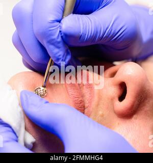 Die Kosmetikerin reinigt die Haut des Patienten mit einem Löffel uno, feuchtigkeitsspendend, reinigend und hautpflegende. Neu Stockfoto