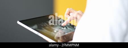 Weiblicher Finger auf Tablette mit humanem Kiefer Stockfoto
